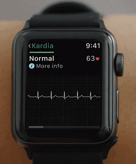 Apple Watch Seri 4 Çeşitleri